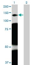 Anti-ARHGAP4 Rabbit Polyclonal Antibody