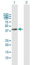 Anti-PARK2 Rabbit Polyclonal Antibody