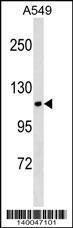 Anti-KIT Rabbit Polyclonal Antibody (AP (Alkaline Phosphatase))