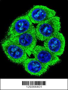 Anti-PATL2 Rabbit Polyclonal Antibody (FITC (Fluorescein Isothiocyanate))