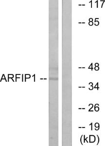 Anti-ARFIP1 [EPR16360] Rabbit Polyclonal Antibody