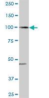 Anti-ARHGAP4 Rabbit Polyclonal Antibody