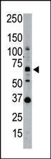 Anti-SENP1 Rabbit Polyclonal Antibody