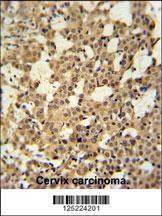 Anti-CJ119 Rabbit Polyclonal Antibody (FITC (Fluorescein Isothiocyanate))