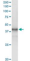 Anti-PARK2 Rabbit Polyclonal Antibody