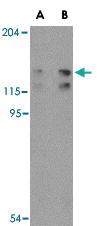 Anti-FYB Rabbit Polyclonal Antibody