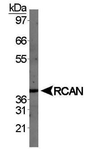 Anti-MBD4 Rabbit Polyclonal Antibody