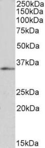 Anti-FOXB1 Antibody (A83939) (1 µg/ml) staining of HepG2 nuclear lysate (35 µg protein in RIPA buffer). Primary incubation was 1 hour. Detected by chemilu minescenc