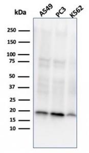 Western blot analysis of (Lane 1) A549 cell line lysate, (Lane 2) PC3 cell line lysate, and (Lane 3) K562 cell line lysate using Anti-NME1 Antibody [NME1/2737]