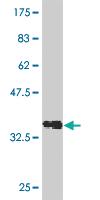 Anti-RCVRN Mouse Monoclonal Antibody [clone: 2B2]