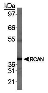 Anti-HDAC6 Rabbit Polyclonal Antibody