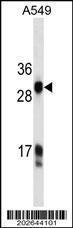 Anti-Prostate Specific Antigen Mouse Monoclonal Antibody [clone: 551CT16.3.5]