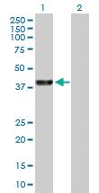 Anti-PARK2 Rabbit Polyclonal Antibody