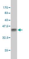 Anti-TP63 Mouse Monoclonal Antibody [clone: 3C2]