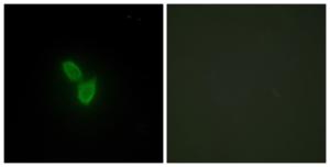 Immunofluorescence analysis of HepG2 cells using Anti-PARD3 Antibody. The right hand panel represents a negative control, where the antibody was pre-incubated with the immunising peptide.