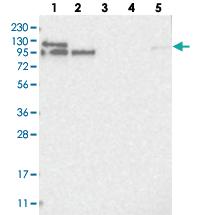 Anti-LARP4B Rabbit Polyclonal Antibody