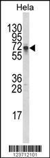 Anti-DTX1 Rabbit Polyclonal Antibody (APC (Allophycocyanin))