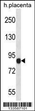 Anti-NLRP6 Rabbit Polyclonal Antibody (PE (Phycoerythrin))