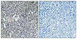 Anti-ARFIP1 [EPR16360] Rabbit Polyclonal Antibody