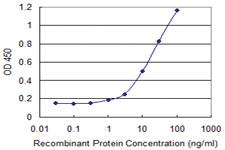 Anti-ARHGAP6 Mouse Monoclonal Antibody [clone: 1G5]