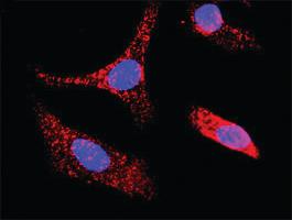 Anti-ERBB2 Antibody Pair