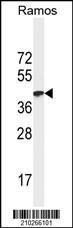 Anti-HLA-A Mouse Monoclonal Antibody [clone: 7G7F9]