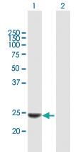 Anti-KLK14 Mouse Polyclonal Antibody