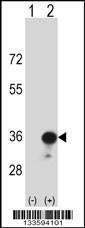 Anti-HLA-DRB4 Rabbit Polyclonal Antibody (Biotin)