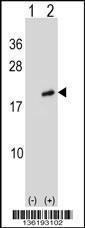 Anti-ARL2 Rabbit Polyclonal Antibody