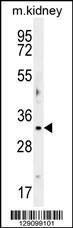 Western blot analysis in mouse kidney tissue lysates (35 µg/lane)