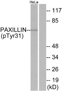 Western blot analysis of lysates from HeLa cells treated with TNF 200 ng/ml 2' using Anti-Paxillin (phospho Tyr31) Antibody. The right hand lane represents a negative control, where the antibody is blocked by the immunising peptide