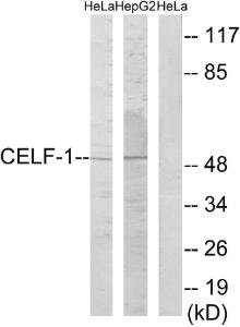 Western blot analysis of lysates from HeLa and HepG2 cells using Anti-CELF-1 Antibody. The right hand lane represents a negative control, where the antibody is blocked by the immunising peptide