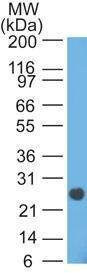 Anti-Lambda Light Chain Mouse Monoclonal Antibody [clone: HP6054]