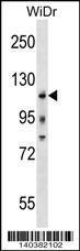 Anti-KIT Rabbit Polyclonal Antibody (Biotin)