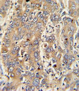 Anti-PIGR Rabbit Polyclonal Antibody (AP (Alkaline Phosphatase))