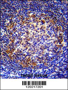 Anti-PAX5 Rabbit Polyclonal Antibody