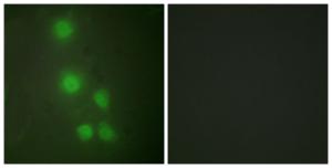 Immunofluorescence analysis of HUVEC cells using Anti-ACTL6A Antibody. The right hand panel represents a negative control, where the antibody was pre-incubated with the immunising peptide