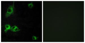 Immunofluorescence analysis of COS7 cells using Anti-LAMA1 Antibody. The right hand panel represents a negative control, where the antibody was pre-incubated with the immunising peptide