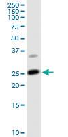 Anti-ARHGDIA Rabbit Polyclonal Antibody