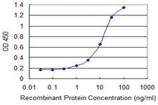 Anti-KLK14 Mouse Monoclonal Antibody [clone: 2A7]