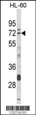 Anti-DTX4 Rabbit Polyclonal Antibody (Biotin)