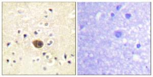 Immunohistochemical analysis of paraffin-embedded human brain tissue using Anti-Ras-GRF1 Antibody. The right hand panel represents a negative control, where the Antibody was pre-incubated with the immunising peptide