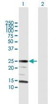 Anti-ARHGDIA Rabbit Polyclonal Antibody