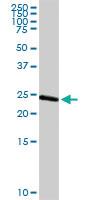 Anti-ARHGDIA Rabbit Polyclonal Antibody