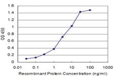 Anti-HTR2C Mouse Monoclonal Antibody [clone: 1A8]