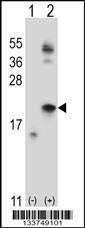 Anti-IL21 Rabbit Polyclonal Antibody