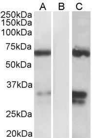 HEK293 lysate (10ug protein in RIPA buffer) over expressing Human FOXC2 with DYKDDDDK tag probed with Anti-FOXC2 Antibody (1.0 µg/ml) in Lane A and probed with anti- DYKDDDDK Tag (1/1000) in lane C