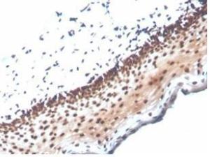 Immunohistochemical analysis of formalin-fixed, paraffin-embedded human cervix tissue using Anti-NME1 Antibody [NME1/2737]