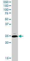 Anti-ARHGDIA Rabbit Polyclonal Antibody