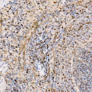 Immunohistochemistry analysis of paraffin-embedded rat spleen using Anti-Metnase Antibody (A9984) at a dilution of 1:100 (40X lens). Perform high pressure antigen retrieval with 10 mM citrate buffer pH 6.0 before commencing with IHC staining protocol